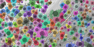 Forestry analysis from airborne LiDAR point cloud data